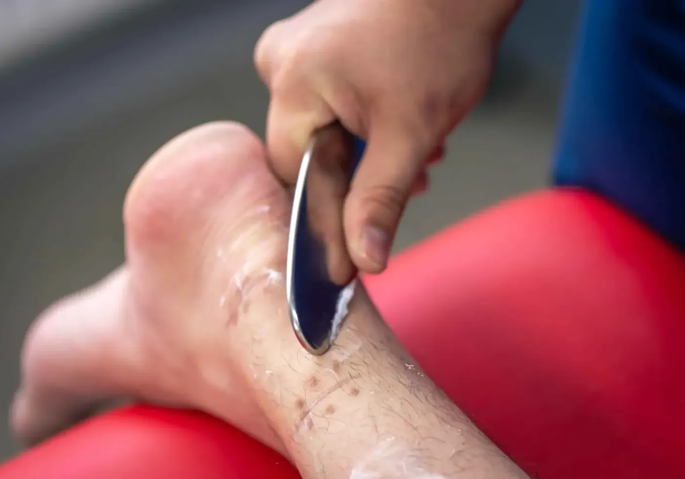 Instrument-assisted soft tissue treatment on a patient's knee